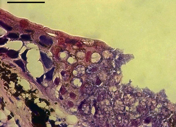 Basal infection in the skin of a fire salamander (Salamandra salamandra), characterized by extensive epidermal necrosis, presence of high numbers of intra-epithelial colonial chytrid thalli, and loss of epithelial integrity. Photo by A. Martel and F. Pasmans, courtesy Wikipedia.