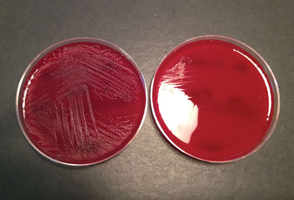 Blood agar plates with (left) and without (right) pyridoxal supplement from a study of neonatal Granulicatella elegans bacteremia, London, UK. Image from Neonatal Granulicatella elegans Bacteremia, London, UK; Emerging Infectious Diseases Vol. 19, no. 7, July 2013.