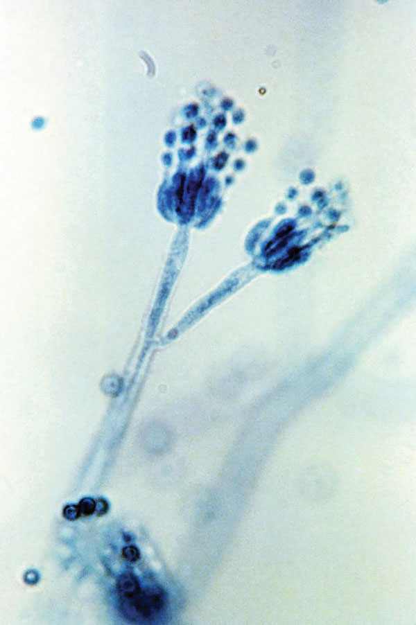 Two conidiophores of Penicillium frequentans fungi, also known as P. glabrum. The conidiophore is the stalked structure whose distal end produces asexual spores (conidia) by budding. Original magnification x1,200.  Photo: CDC/Lucille Georg/1971.