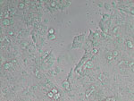 Thumbnail of Neospora caninum, a coccidian parasite, which identified as a species in 1988. It is a major cause of spontaneous abortion in infected livestock.Image from WIkipedia.