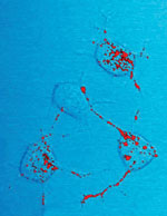 Thumbnail of This photomicrograph of a neural tissue specimen, harvested from a scrapie affected mouse, revealed the presence of prion protein stained in red, which was in the process of being trafficked between neurons, by way of their interneuronal connections, known as neurites. Prion proteins can become infectious, causing neurodegenerative diseases such as transmissible spongiform encephalopathies (TSEs), which includes bovine spongiform encephalopathy (BSE), more commonly referred to a mad