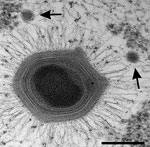 Thumbnail of Mimivirus, Acanthamoeba polyphaga mimivirus, with two satellite Sputnik virophages (arrows) Thin-section electron microscopy courtesy of J.Y. Bou Khalil and B. La Scola, IHU Mediterranée Infection, France.