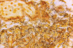 Tissue sample stained with Steiner silver stain. Image shows numerous, corkscrew-shaped, darkly-stained, Treponema pallidum spirochetes, which cause syphilis. Skip Van Orden, Centers for Disease Control, 1966.