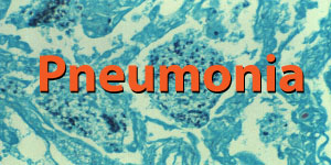 Pneumonia Spotlight