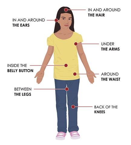 Bug Bites in a Line: Type of Bug, Treatment & Prevention