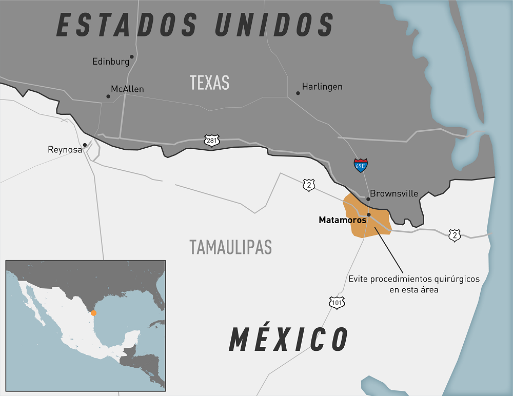 Mapa de México con la localidad de Matamoros, México, resaltada. Evite procedimientos en esta área que incluyan una inyección epidural de un anestésico.